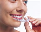 Sanadent tandregulering Tandretning med Invisalign i Holbæk