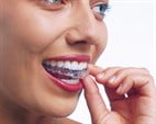 Sanadent tandregulering Tandretning med Invisalign i Holbæk
