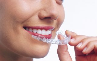 Tandretning med Invisalign