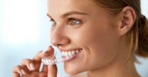 1204×629 Invisalign tandretning 76141646 Usynlig tandretning hos dygtig tandlæge